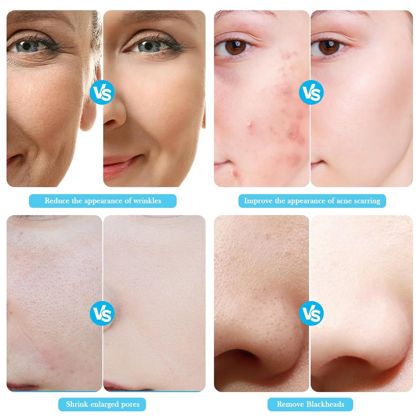 Water Oxygen Jet Beauty Machine Multifunctional Vacuum Machine Deep Clean Hydro Dermabrasion Facial Machine Home SPA Micro Bubble Cleansing Skin Care