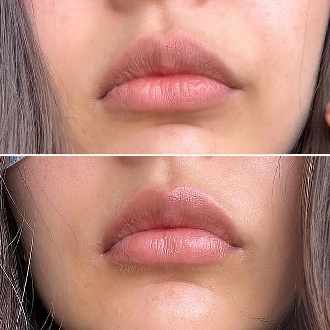 Talika Smile Patch | New Hydrating Lip Mask | Helps To Moisturize, Replenish And Nourish The Lips