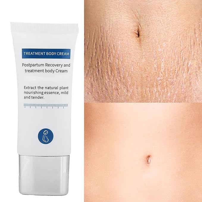 Generic Stretch Marks Removal Cream, Reduce Old Marks, Restore Elasticity, Firm & Lift Skin, Safe & Ingredients, 30g, Compact Size