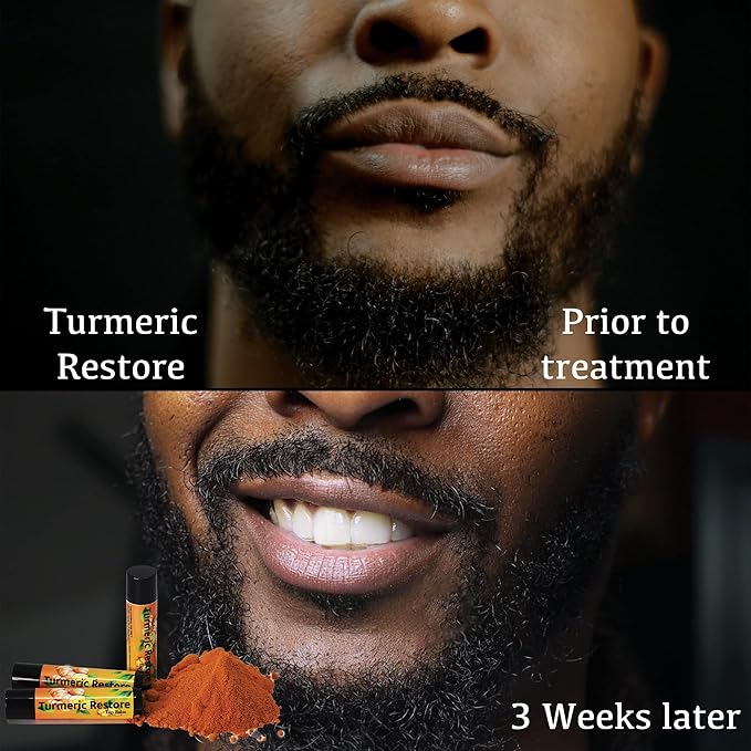 Turmeric Lip balm | Turmeric Restore | Natural Lip Balm | Organic Lip Balm | Natural Lip Balm | Lip Moisturizer | 100% Natural Ingredients | Habbie Beauty Supplies (6 Pack)