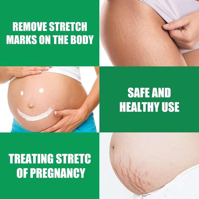 Wrinkle-Relaxing Firming Repair Essence Cream - Removes Maternity Stretch Marks, Prevents Wrinkles & Fine Lines, Nourishes & Rejuvenates Skin with Safe, Natural Formula