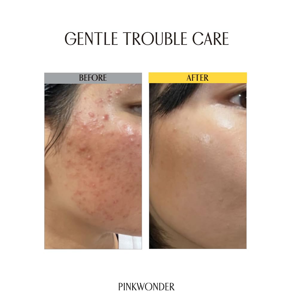 PINKWONDER Tamanu Hero Ampoule⁺ 1.69oz (50ml), 50,000ppm Tamanu Oil for Soothing