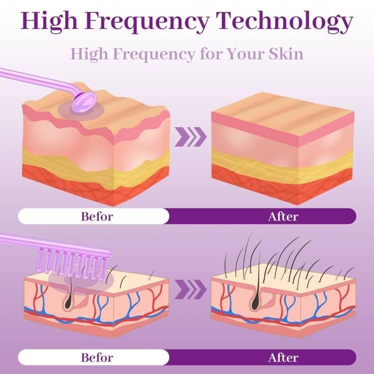 High Frequency Facial Wand - TUMAKOU Violet Portable Handheld High Frequency Facial Skin Machine Device for Face - with 4 Purple Tubes