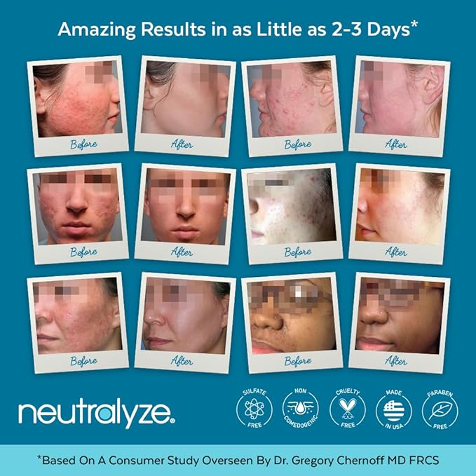 Moderate To Severe Acne Treatment Kit 2.0 (Clearing Serum & Synergyzer)