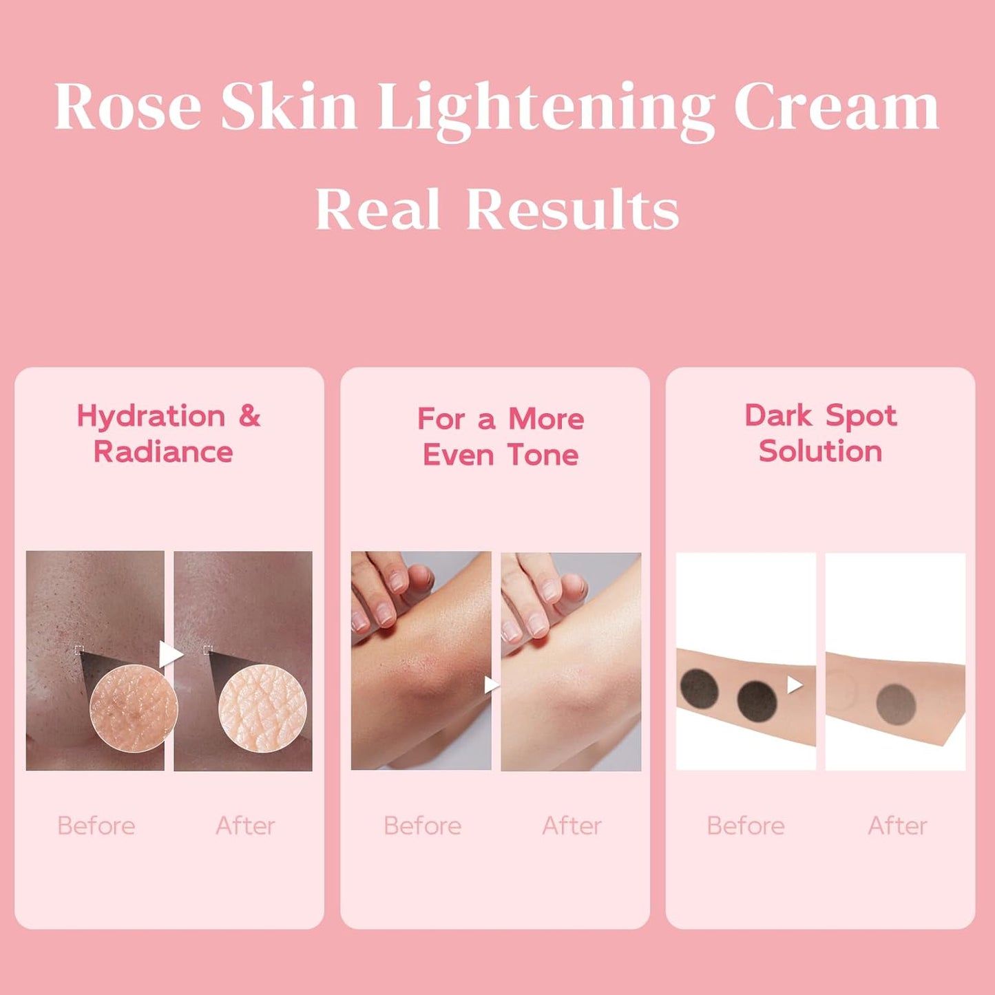 Underarm Lightening Cream - Skin Lightening Cream - Intimate Areas, Inner Thigh, Armpit, Dark Elbows and Knees, Bikini Areas, Underarm, Private Parts, 1.69 fl.oz