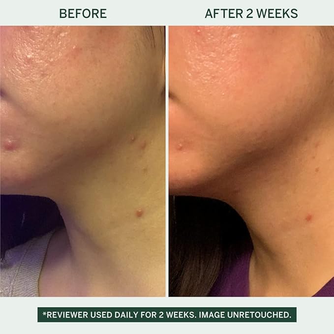 Urban Calm Collection - Fermented Skincare Bundle - for All Skin Types - Anti-Aging Skincare Set for Hydrating, Firming, Exfoliating, Soothing - With Cleanser, Essence, Serum, and Cream