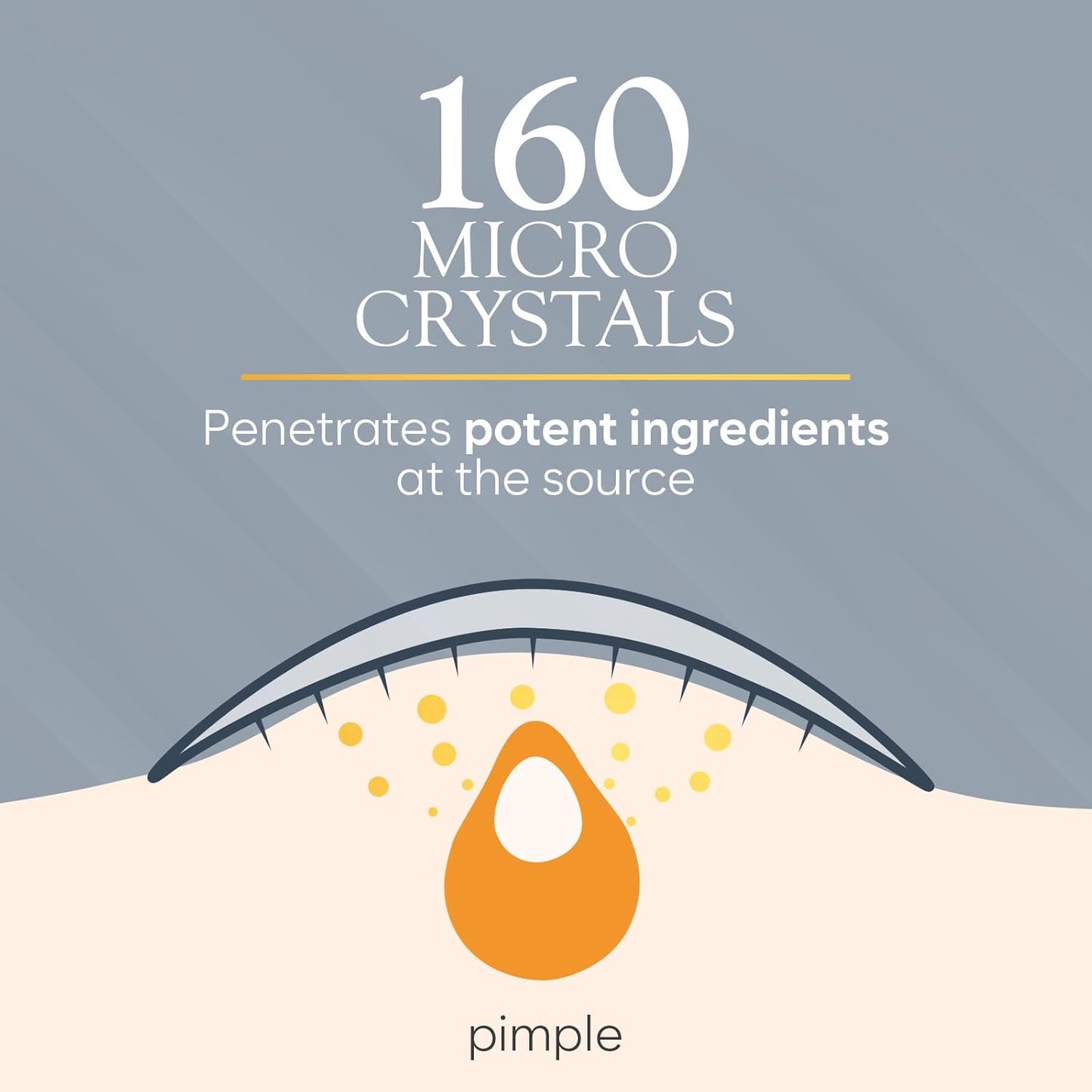 Microdart Acne Patch, Zit Patches for Cystic Acne Overnight Care, Cystic Acne Coverage, Pimple Patches Microdart Technology - Salicylic & Hyaluronic Acid (12 Count)