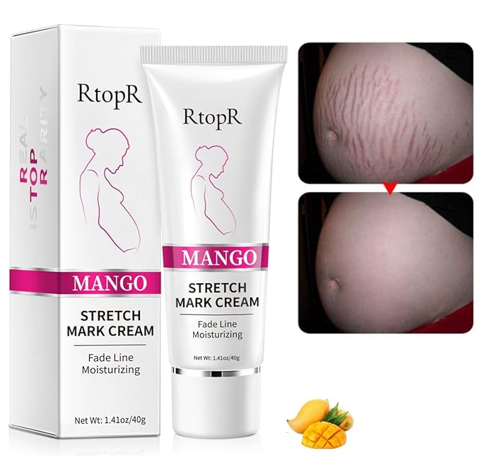 Stretch Mark Removal Cream, Obesity Stretch Mark Moisturizer, Postpartum Repair Stretch Mark Cream, Abdominal Stretch Mark Cream, Remove Marks (2 PCS)