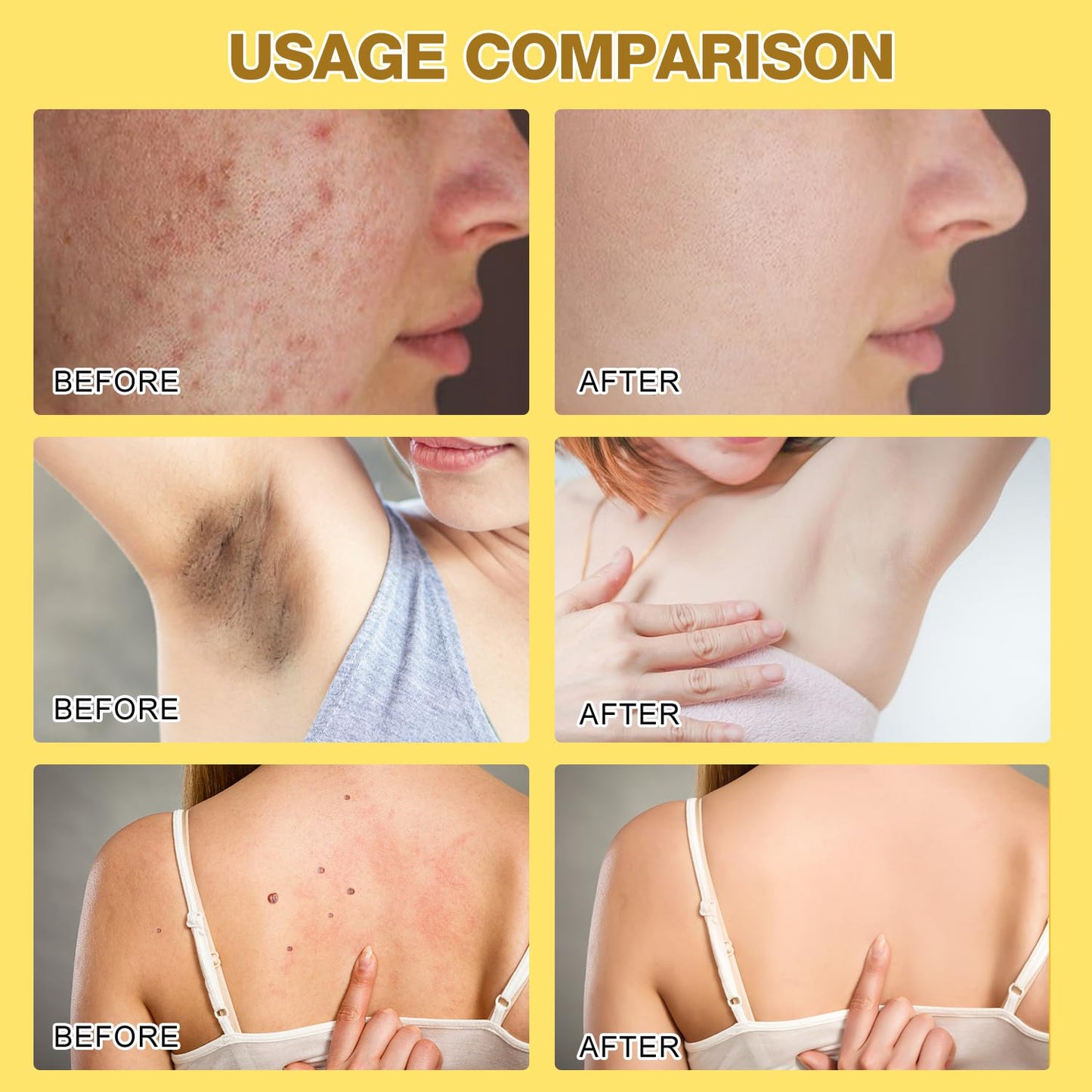 Bee Venom Treatment, New Professional Bee Venom Repair Cream,Bee Venom Moisturizing Gel, Natural Bee Venom Repair Cream, for All Types (2pcs)