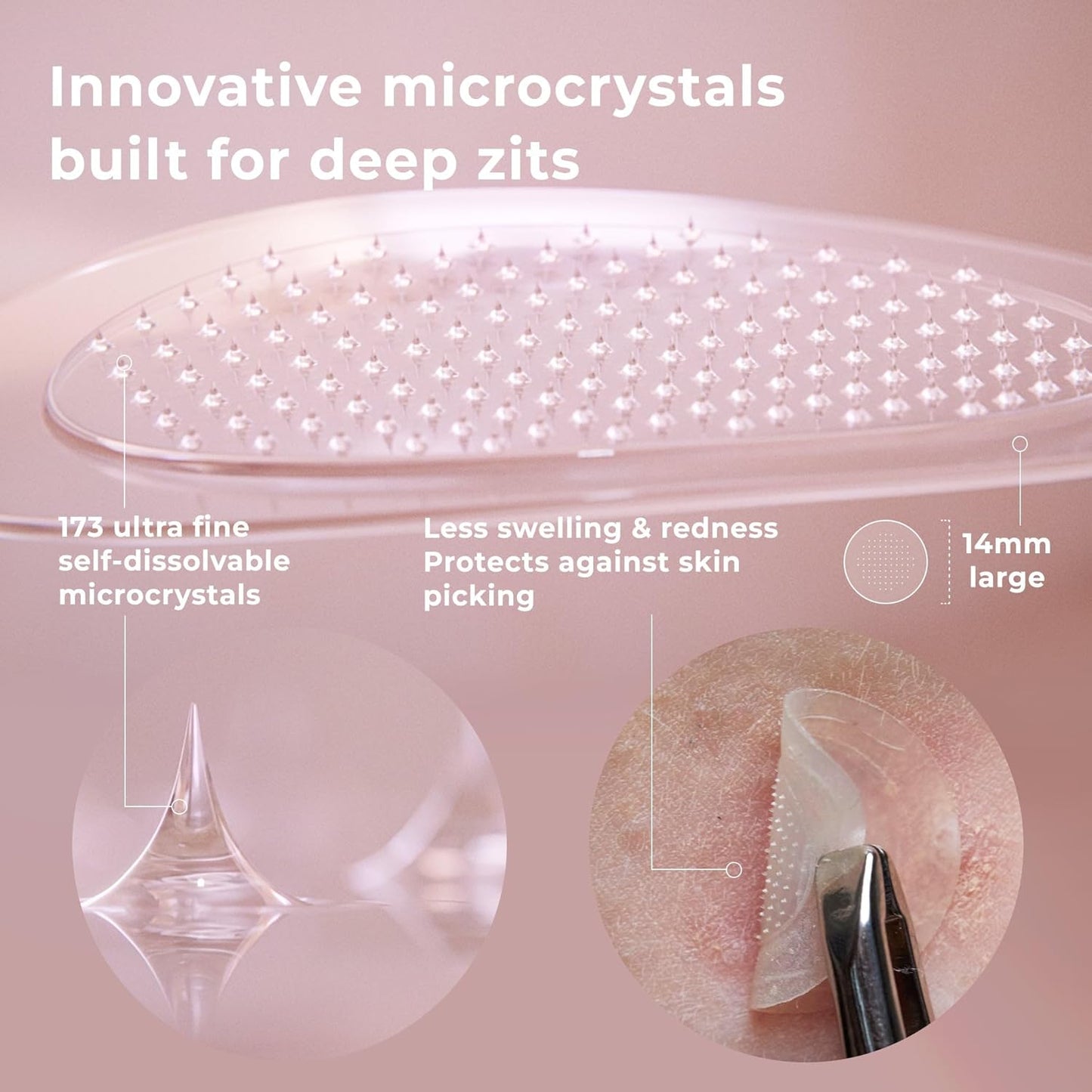 OMMA Korean Microdart Acne Patch, Cystic Acne Treatment, Micropoint Pimple Patches for Face for Early-Stage Painful Zits, Salicylic Acid & Tea Tree - 14 mm Zit Stickers (18 Count)