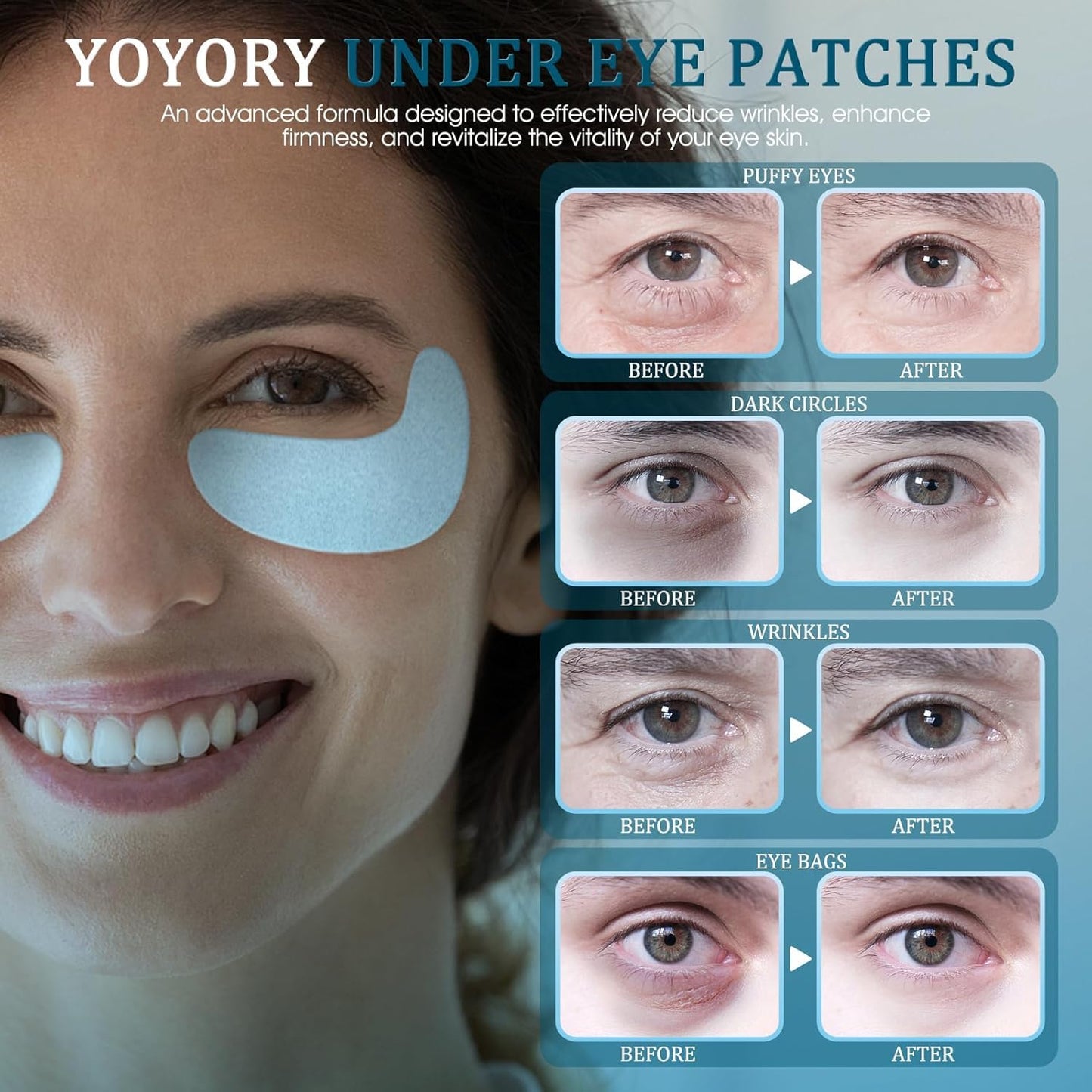 Under Eye Patches Masks - for Fine Lines with Collagen and Hyaluronic Acid, Dark Circles,and Fade Wrinkles, puffiness Smoothing Skin Care Treatment for Women and Men, (30 Pcs) white