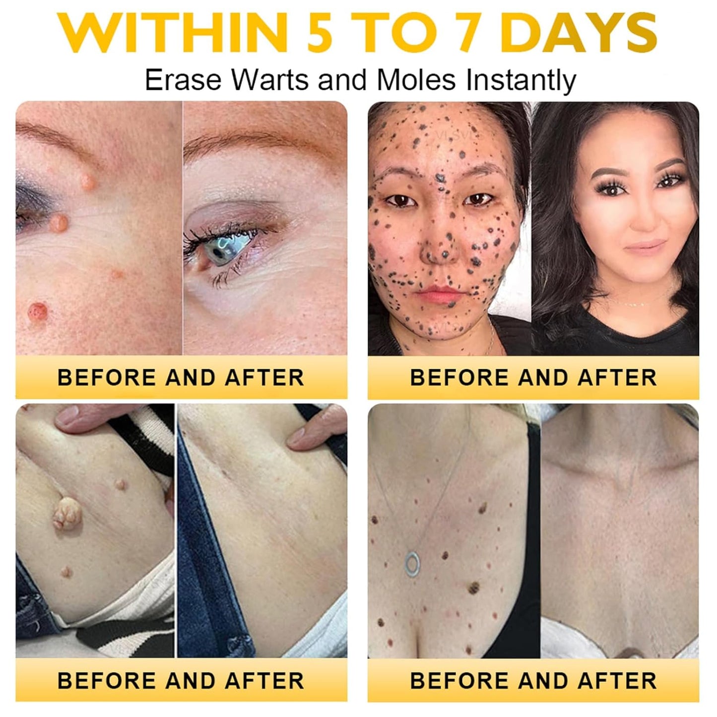 Bee Venom Skin Restoration Cream, Bee Venom Skin Treatment Cream, Professional Bee Venom Comprehensive cream - Anti-Wrinkle Moisturizing for All skin Typess (4)