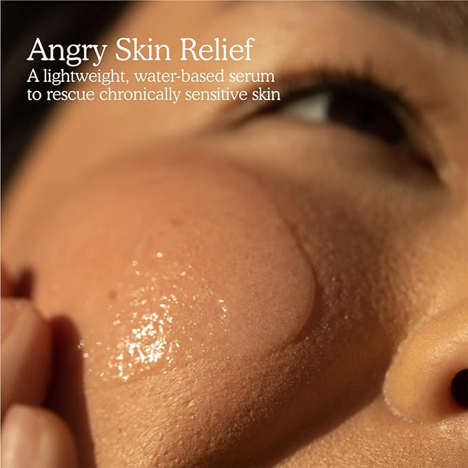 Tower 28 SOS Intensive Rescue Serum for Sensitive Skin, Hypochlorous Acid Skin Care, Helps Reduce Face Redness, Safe for All Skin Types, 2 FL Oz