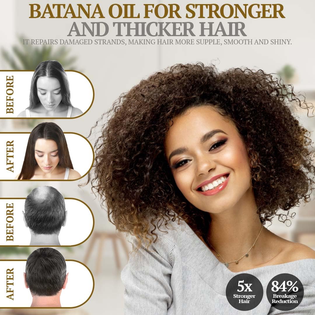 Batana Rosemary Oil For Hair Growth - Dr Sebi Organic Hair Growth Oil For Thickening, Deep Conditioning & Scalp Stimulation, Honduras Pure Dr Truth Blend for Men & Women, 4 oz