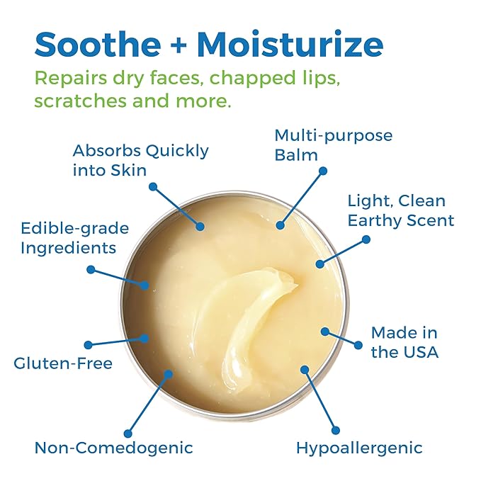 Waxhead Aftersun Body Butter for Sunburn Relief - Also great Tattoo Balm, Eczema Cream for Kids Adults, After Sun Lotion, Sunburn Treatment, Healing Salve