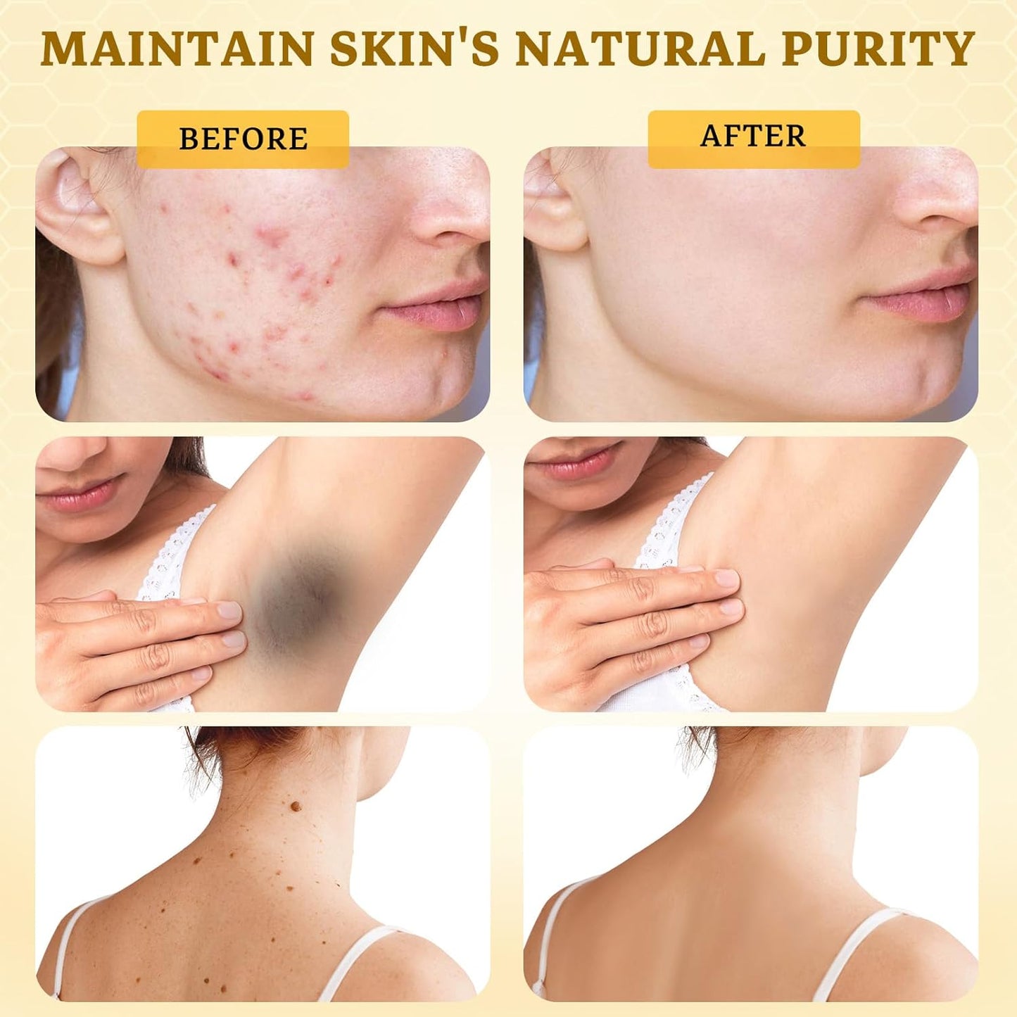 2PCS Bee Venom Comprehensive Cream: Wrinkle Care Face Lift & Firming, Effective In Reducing Skin Blemishes, Natural Care and Non-Irritating, Bee Venom Joint Cream for All Body Parts, 60g * 2PCS