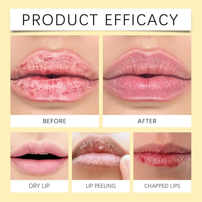 Lemon Lip Balm | All Natural Turmeric Lip Balms & Moisturizers | Hydrates Care Lip Balm, Brighten & Nourish Dark Lips Effortlessly