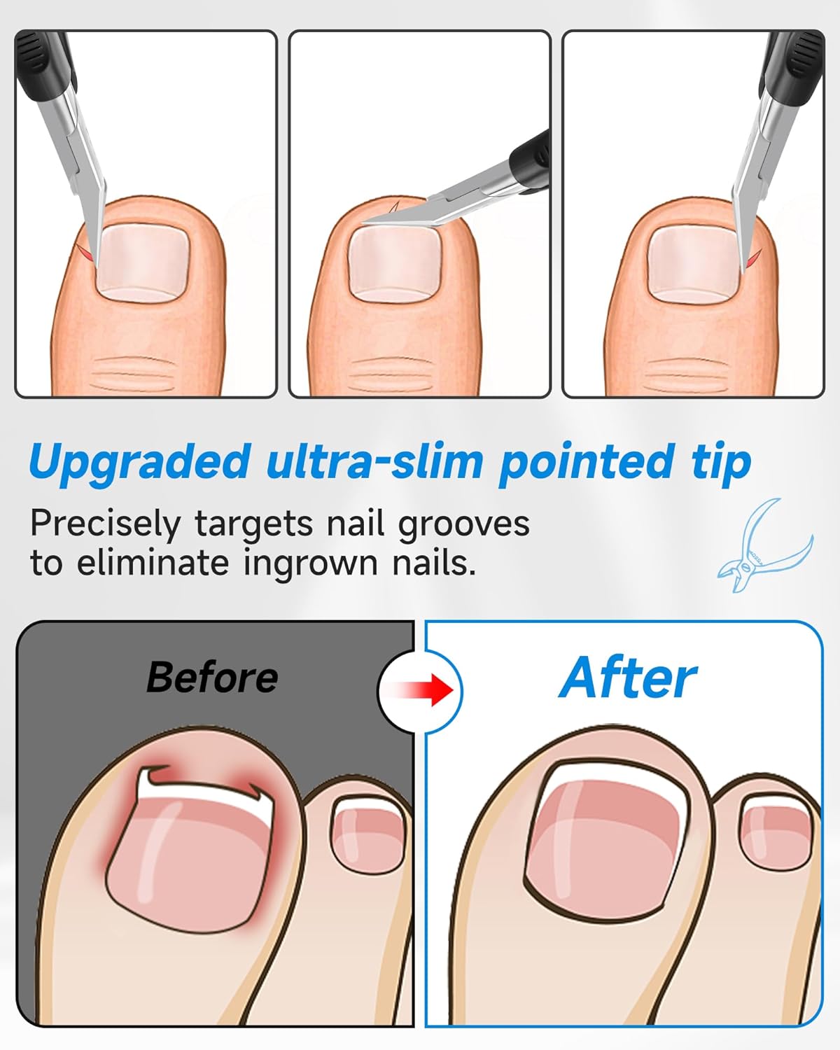 Nail Clippers,Toenail Clipper for Ingrown or Thick Toe Nails,Fingernail Clipper for Men Women Seniors with Stainless Steel Straight Blade Soft Handle Nail Cutter Black