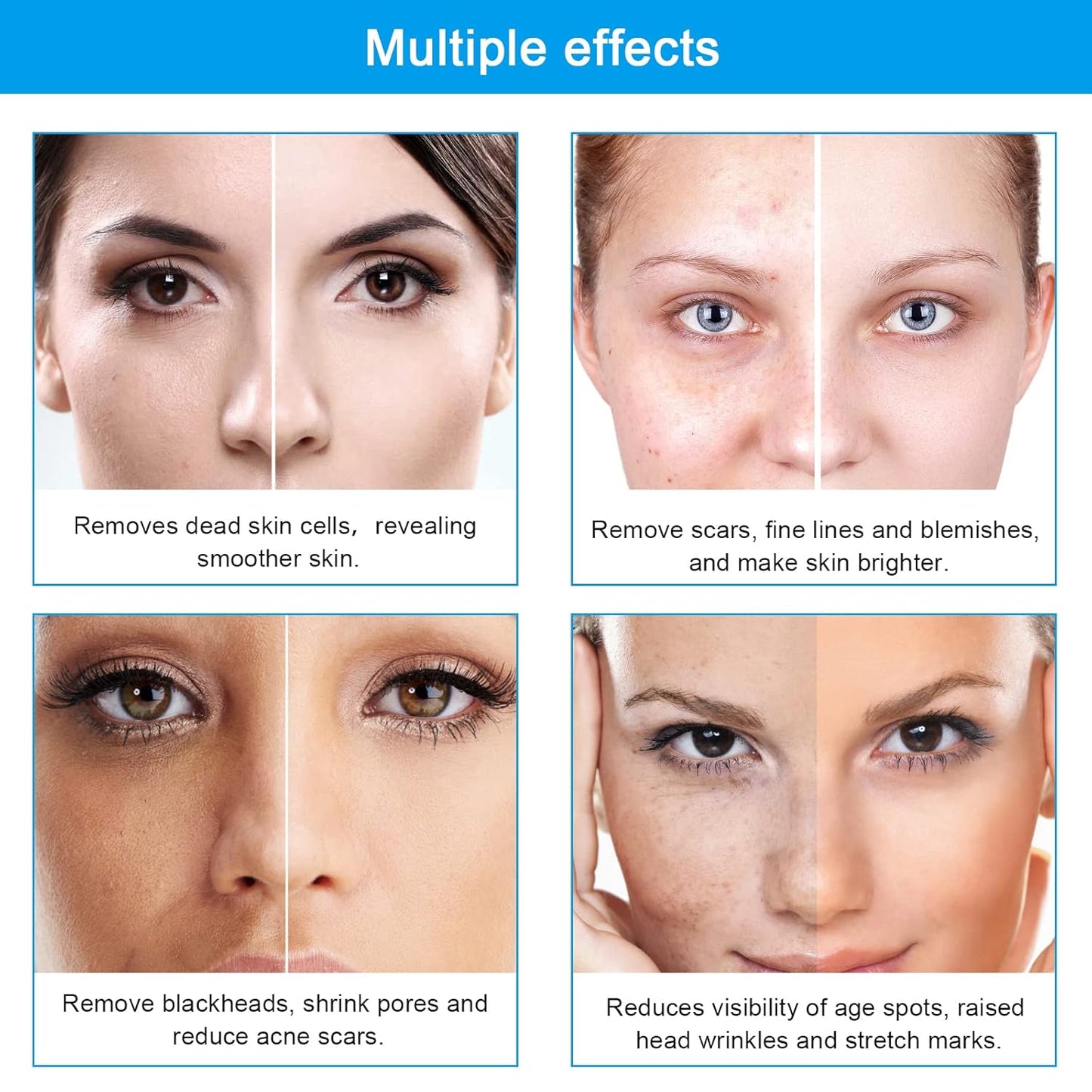 Diamond Microdermabrasion Machine Professional Dermabrasion Machine Facial Care Salon Equipment for Vacuum Blackhead Removal