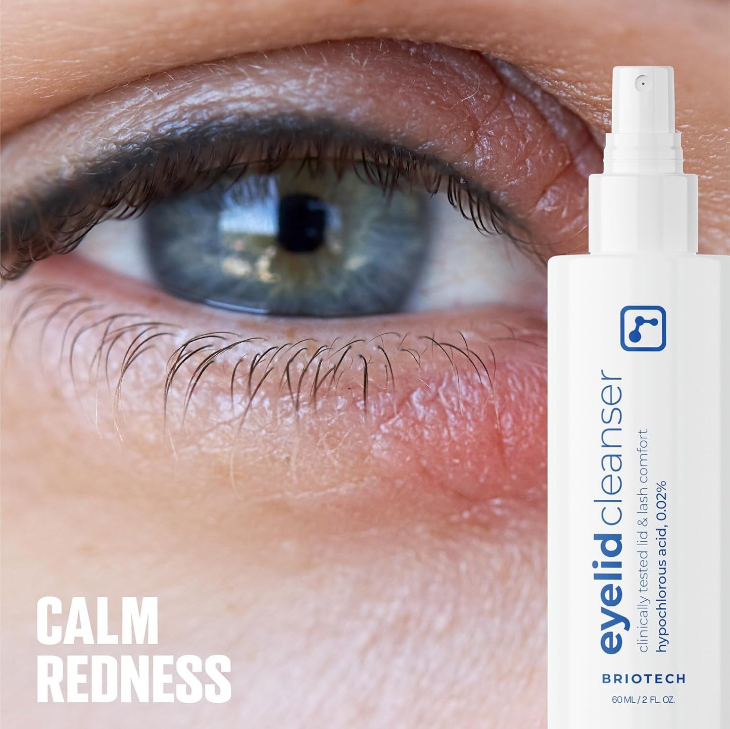 BRIOTECH Eyelid Cleanser, Hypochlorous Acid Spray, Lid & Eyelash Cleanser, Soothe Sensitivities, Calm Redness & Bumps, Support Against Irritation, Vegan, Travel Size 2 Fl oz (2 Pack)