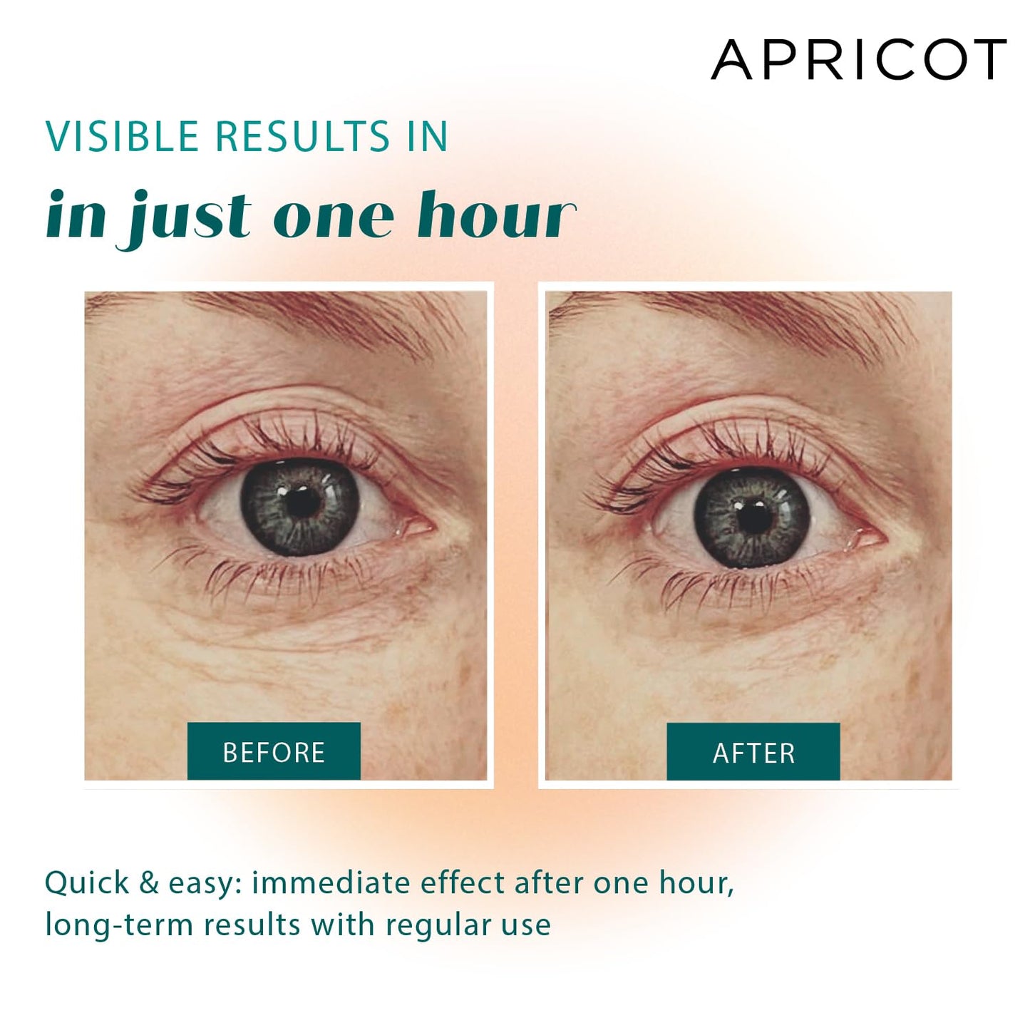 APRICOT Eye Patches with Hyaluronic Acid (pack of 1) I Anti-Aging Eye Pads "Me,Myself and Eye" I Reduces eye wrinkles I Reusable eye patches I Silicone pads against wrinkles I Made in Germany