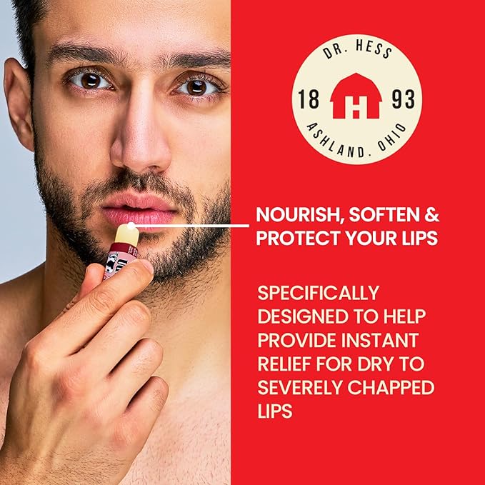 Original Udder Stick SPF Lip Balm, Soothing Moisturizer Sun Screen Balm for Dry Lips with Jojoba, Beeswax & Shea Butter, Total Lip Care, Hydration & Repair, Cherry Flavor, 4 Pack