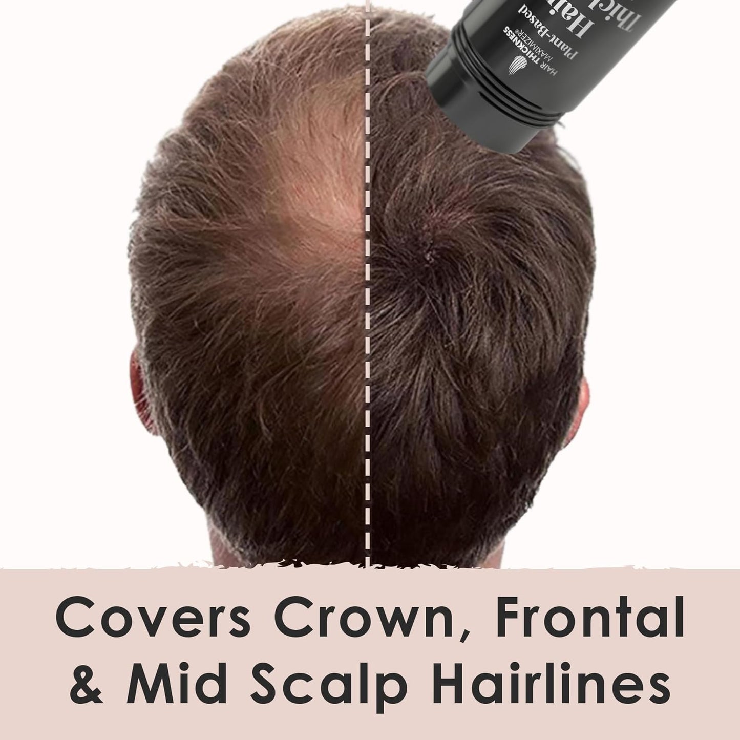 Hair Fibers for Thinning Hair For Women, Men. Plant-Based Formula for Instant Hairline & Bald Spot Coverage. Non-Itchy, Easy to Wash Out (Dark Brown)
