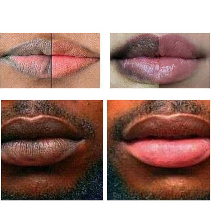 2pcs Lip Lightening for Dark Lips Lip Brightener for Smokers Dark Lip Treatment Lightening Cream for Pink Lips Lip Lightener for Smoker Lips Lip Lightening balm for Men and Women (Red)