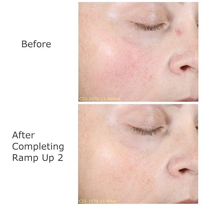 Hydrate & Soothe Beauty Collection Gift Bundle / Starter Kit, Activator with 0.05% Retinol Cream, Ramp-Up Regimen 2 & RHR Overnight Mask, Skin Care Routine, For All Skin Type