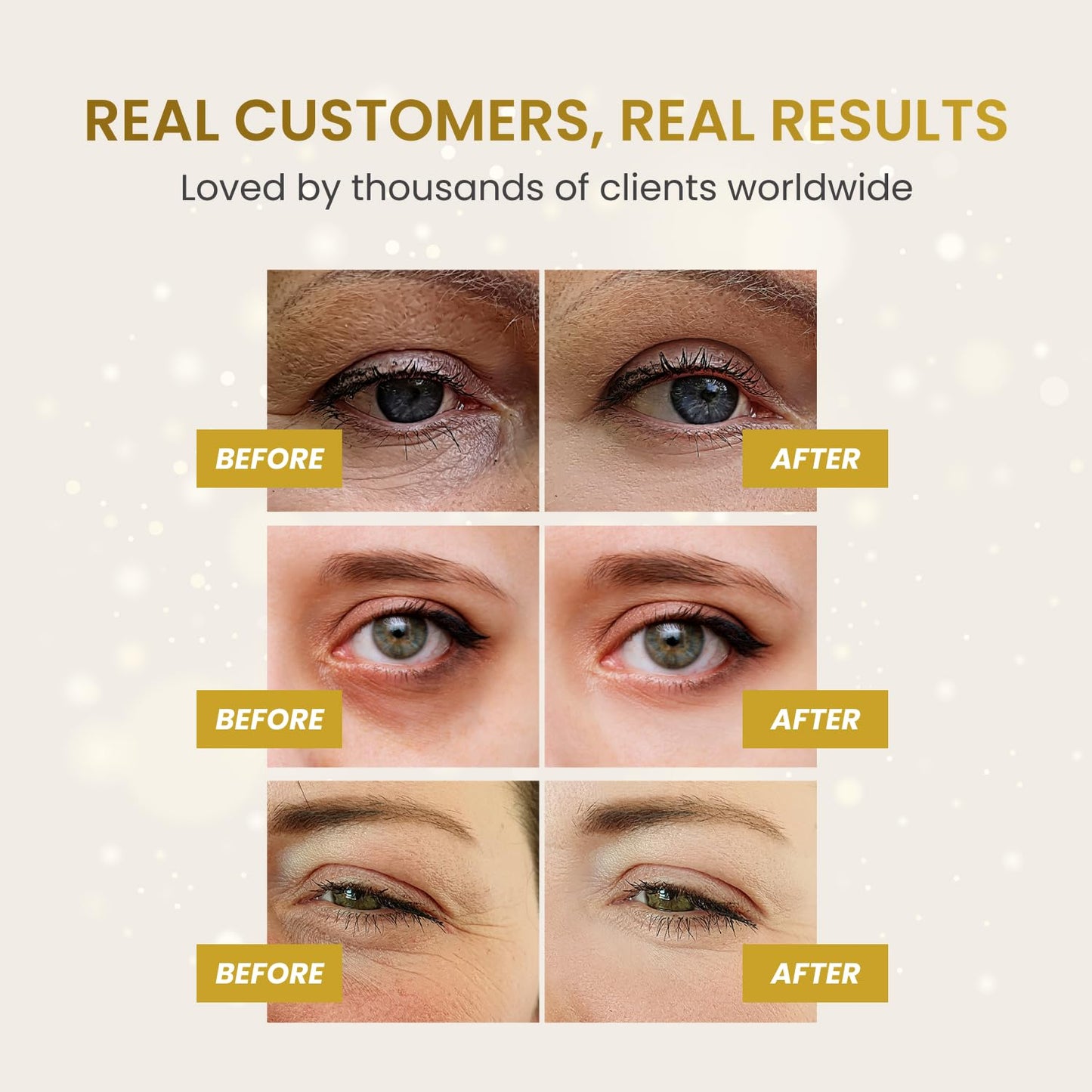 PLANTIFIQUE Gold Eye Patches for Puffy Eyes | 30 Pairs | Gifts | Under Eye Masks for Dark Circles | Puffiness Eye Gels | Eye Mask Skincare