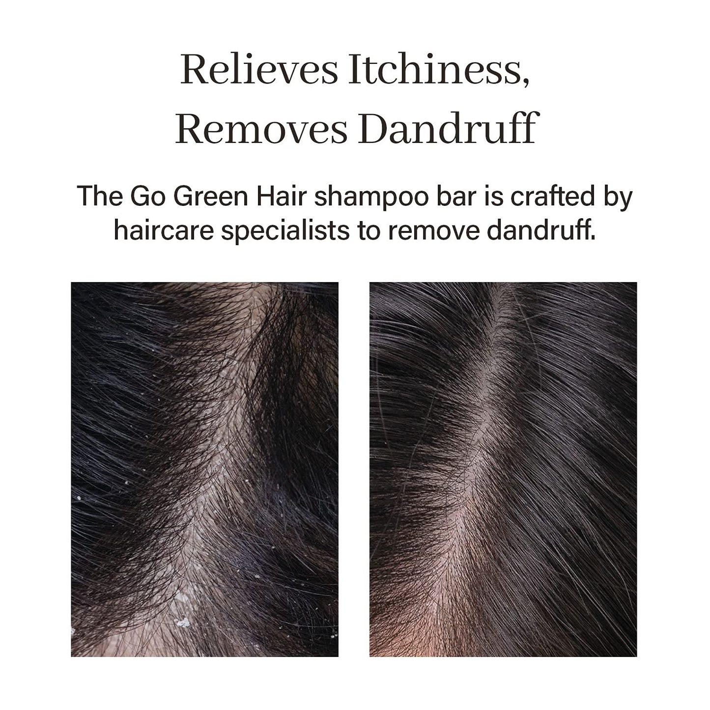 Go Green Tea Tree Shampoo Bar for Dandruff, Itchy Scalp, Normal to Oily hair – Refreshing Anti-dandruff, Vegan, pH balanced, Sulfate free, Eco friendly