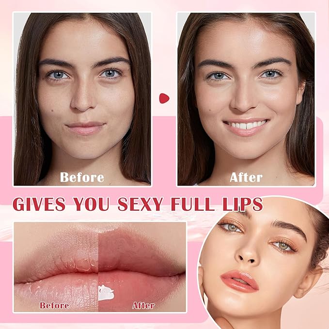 Honey Lip Balm (Strawberry, Watermelon) - Smooth, Hydrating Propolis Lip Mask Overnight Scrubs Exfoliator, Natural Ingredients, Lip Care Set