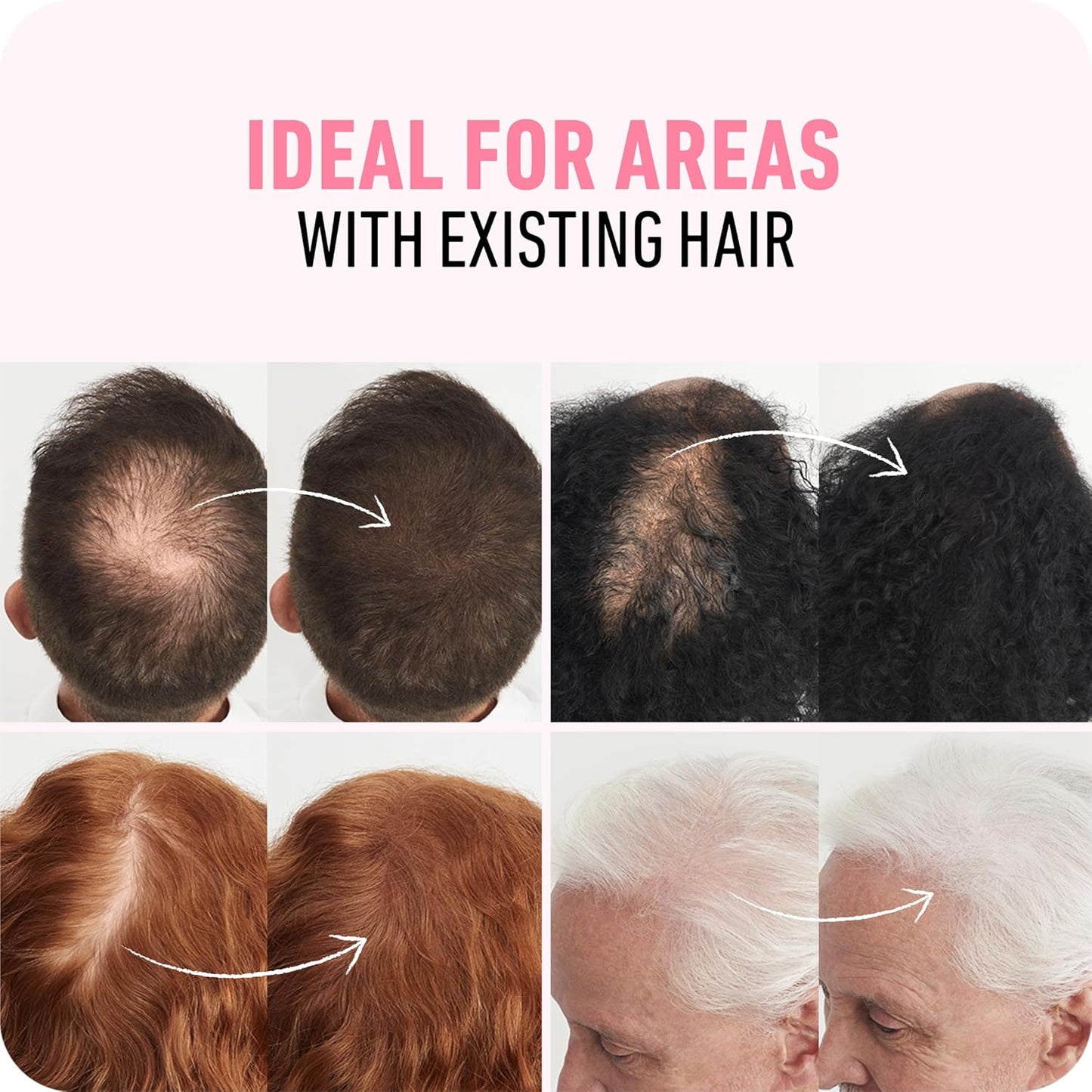 BOLDIFY Hair Fibers (28g) - Fill In Thinning and Fine Hair for an Instantly Fuller, Thicker Look - 14 Shades for Women & Men - Dark Brown