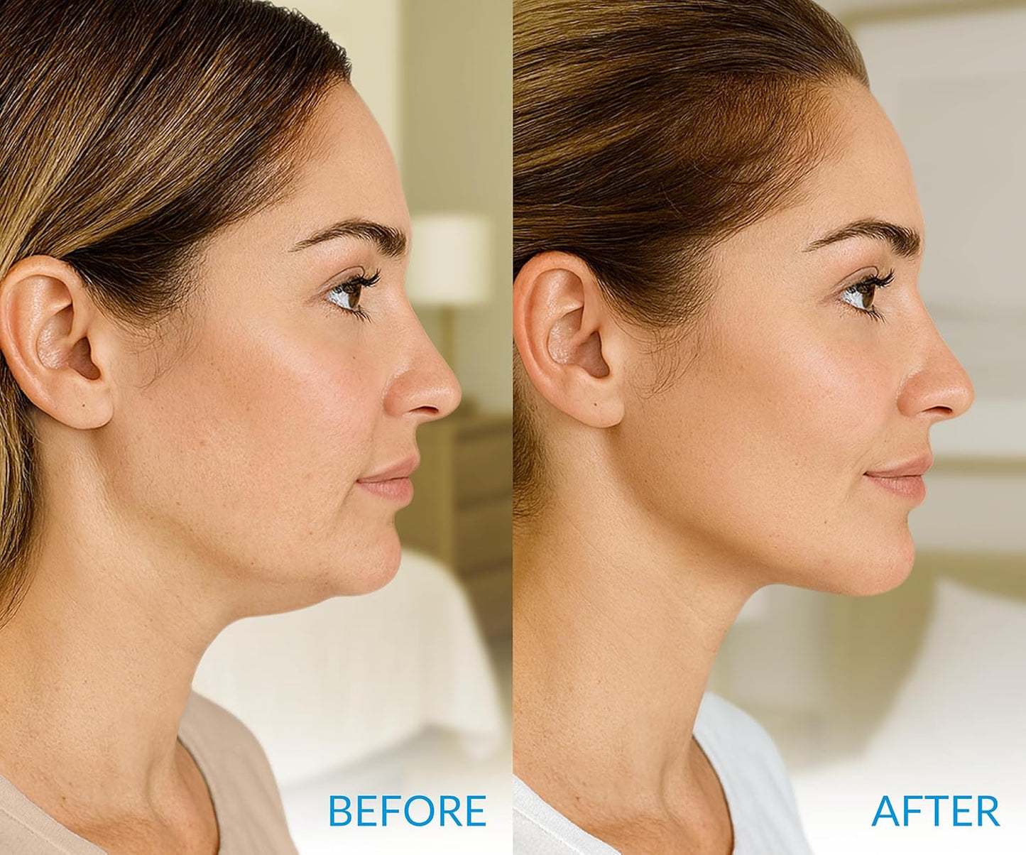 Stylia MaxiLift V-Line Lifting Collagen Face Mask – Enhanced Double Chin Reducer – Jawline Shaper Face Lifting Masks – Firming Neck Lift Collagen Mask – Chin Strap for Sleeping – Hyaluronic Aloe 10PC