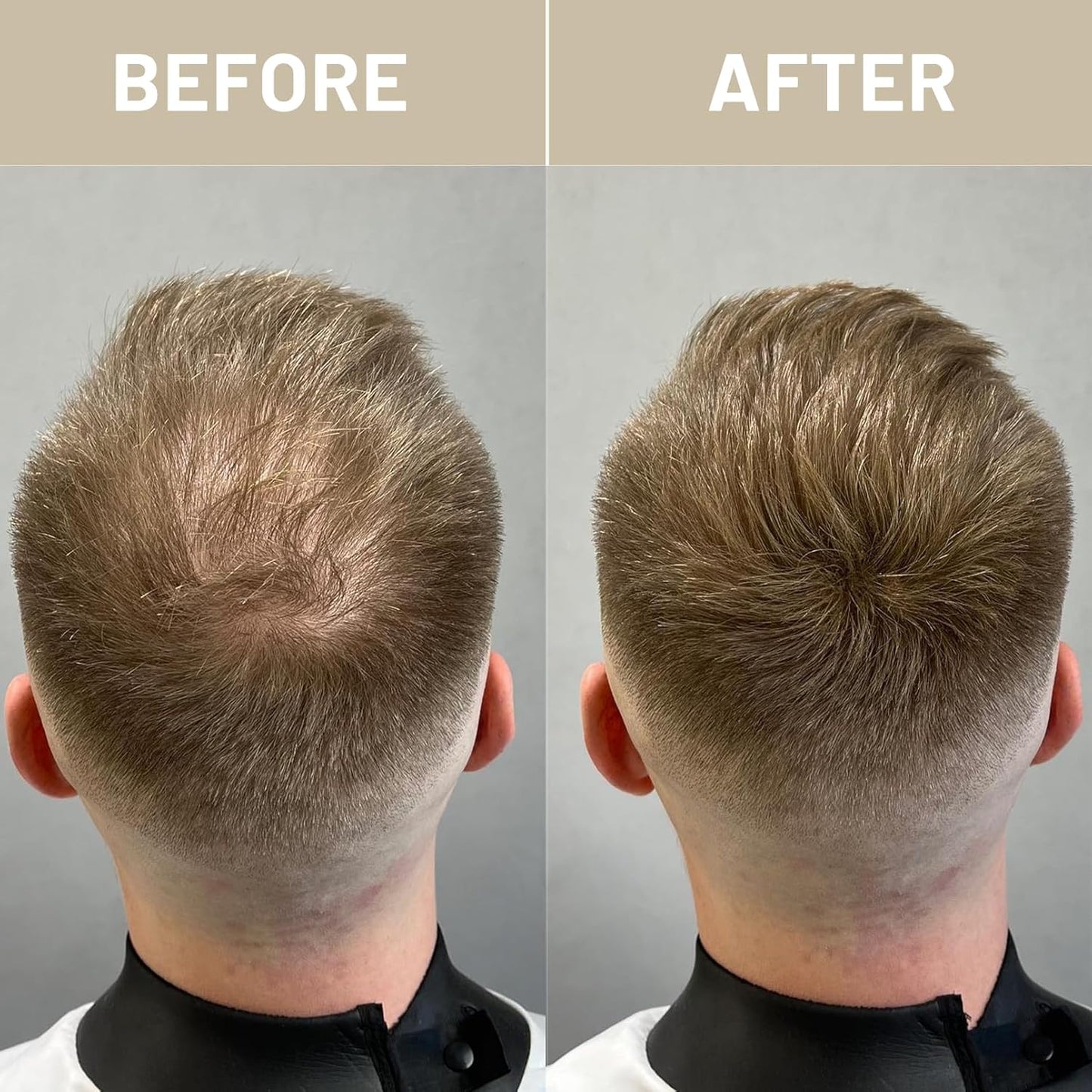 VOLLUCK Hair Fibers for Thinning Hair, Instant Coverage Hair Building Fibers for Women and men, Natural Hair Powder for Conceal Hair Loss 28 g (Gray)