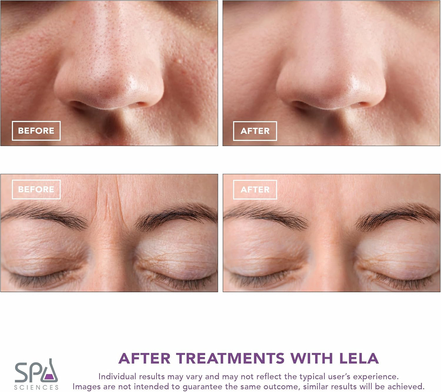 Spa Sciences - LELA - 4-in-1 Facial Spatula for Deep Cleansing, Pore Extraction, Serum Infusion, Anti-Aging and Contouring