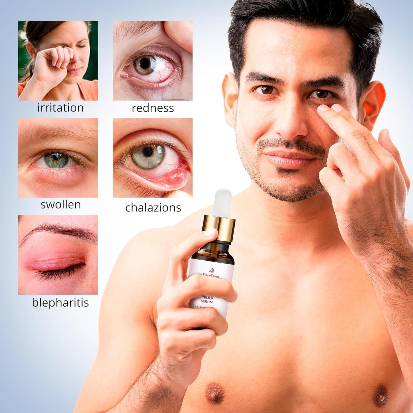 Roycederm Stye Eye Treatment Serum: Natural Stye Remover for Styes Chalazion and Blepharitis - Safe & Fast Relief
