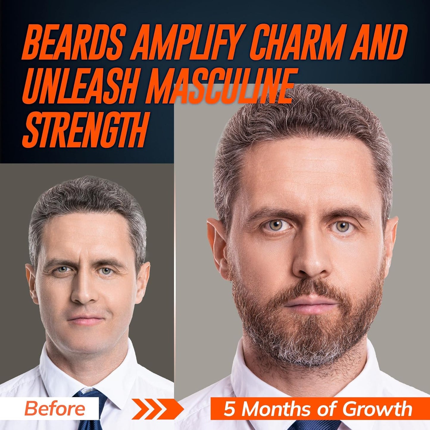 5% Minoxidil Beard Growth Serum for Men: 2-Pack Hair Regrowth Spray with Biotin & Rice Water - Extra Strength Beard Oil for Faster Thicker and Fuller Beard Growth - 4.06 Fl Oz