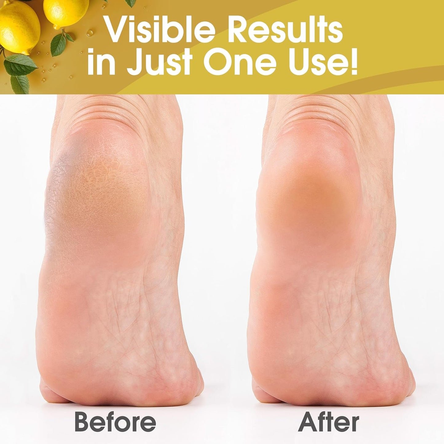 DeEnti Callus Remover for Feet, Extra Strength Foot Callus Remover Gel, 8oz Salon Grade Home Pedicure Supplies for Dry Skin, Cracked Heel, Professional Strength Foot Care, Lemon