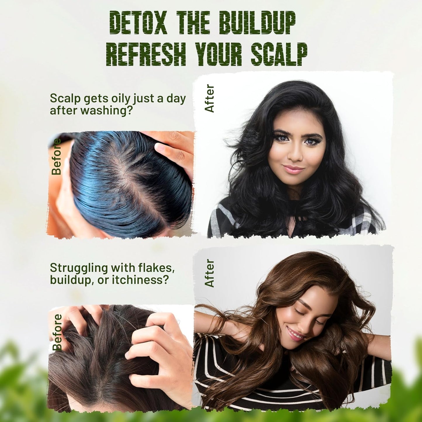 Herbishh Tea Tree & Mint Shampoo Bar – Tea Tree Oil Soap Bar for Oily Hair & Scalp Cleanse – Solid Travel Size Shampoo for Men & Women – Minty Deep Cleansing, 3.53 oz